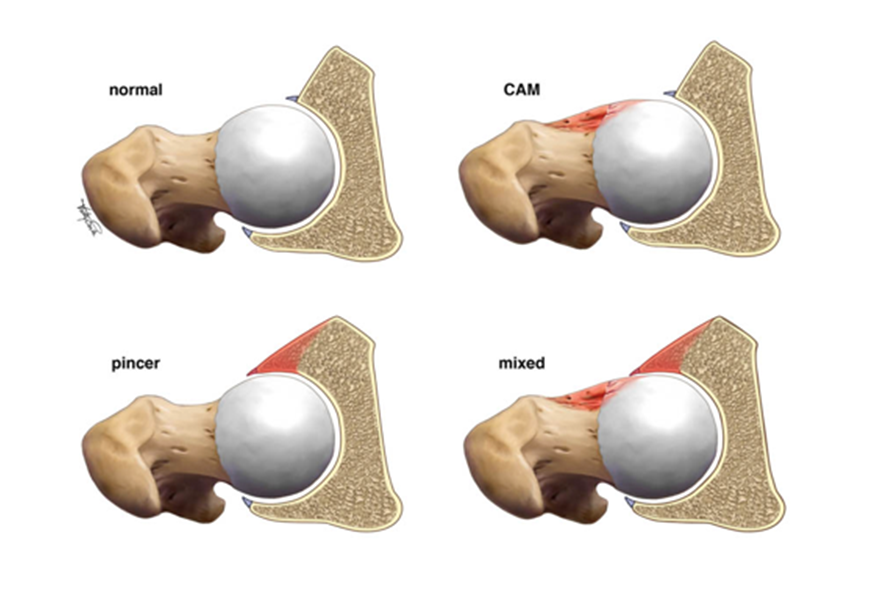 FAI Condition