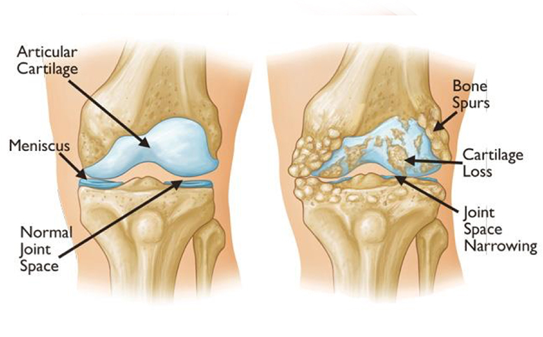 Knee Description