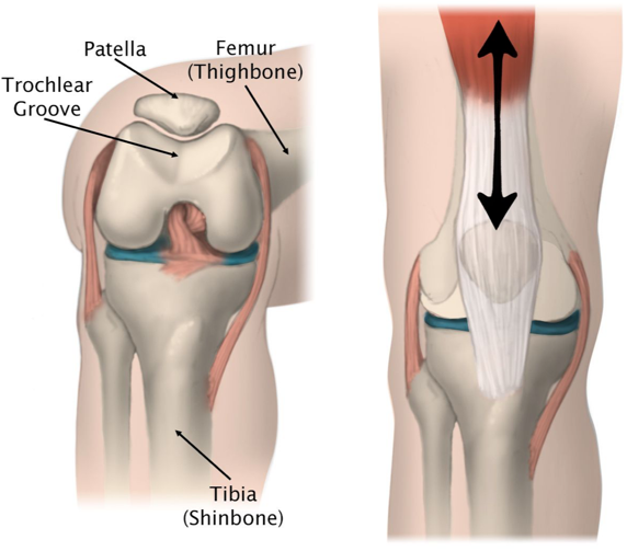 Patellar Dislocation