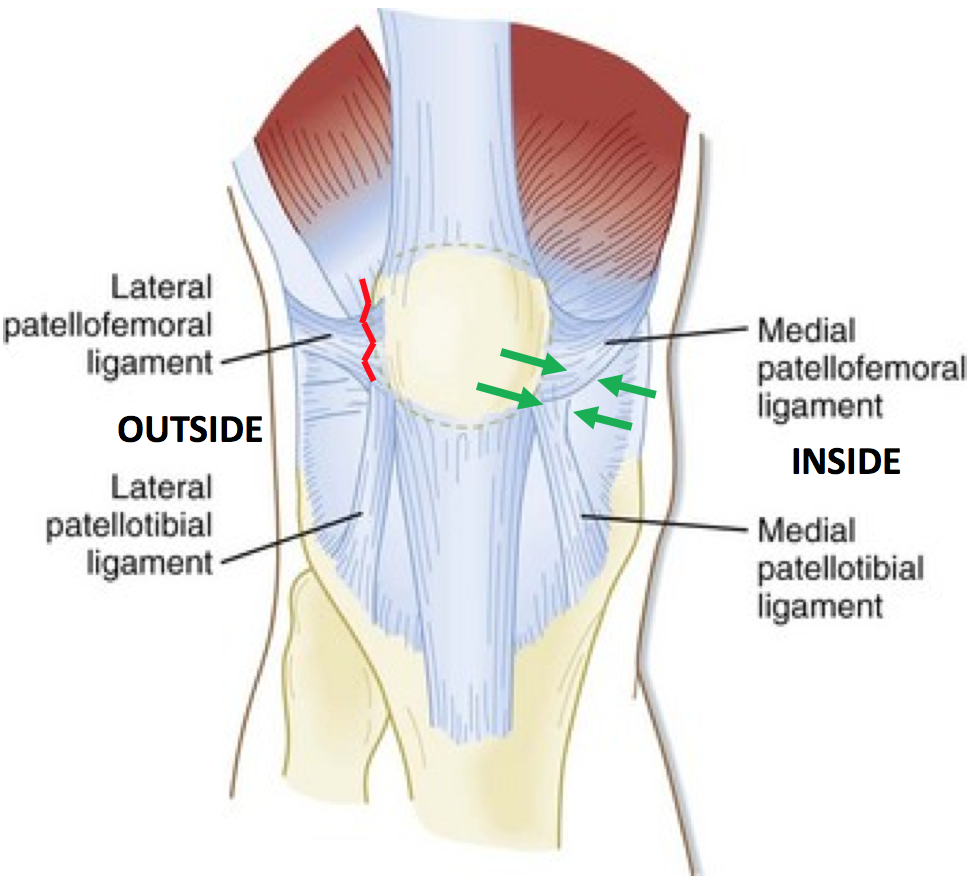 Patella Stabilisation Treatment | David Slattery