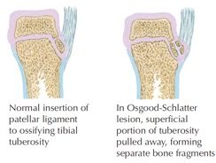 Osgood Diagram