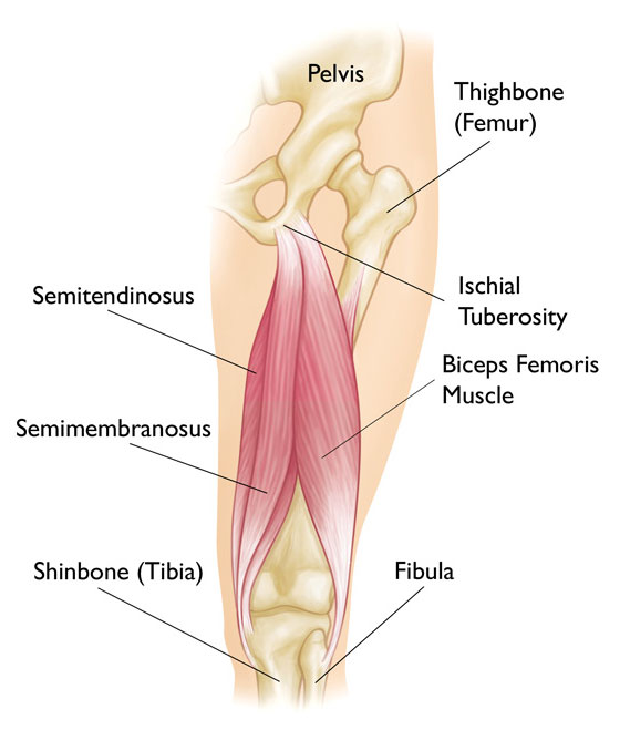 Hamstring Injury Surgery Melbourne - Hamstring Tear Recovery